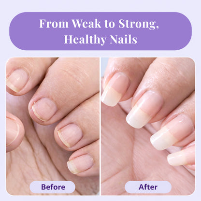 NailRenew™ Growth & Repair Pen