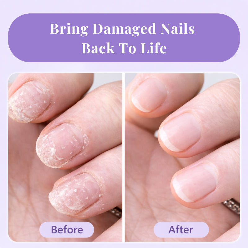 NailRenew™ Growth & Repair Pen