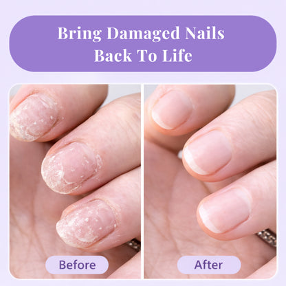 NailRenew™ Growth & Repair Pen