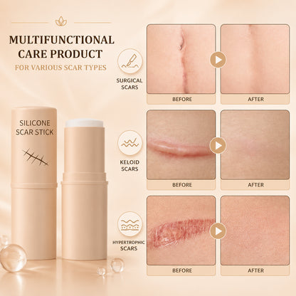 ScarEase™ Silicone Scar Fading Stick