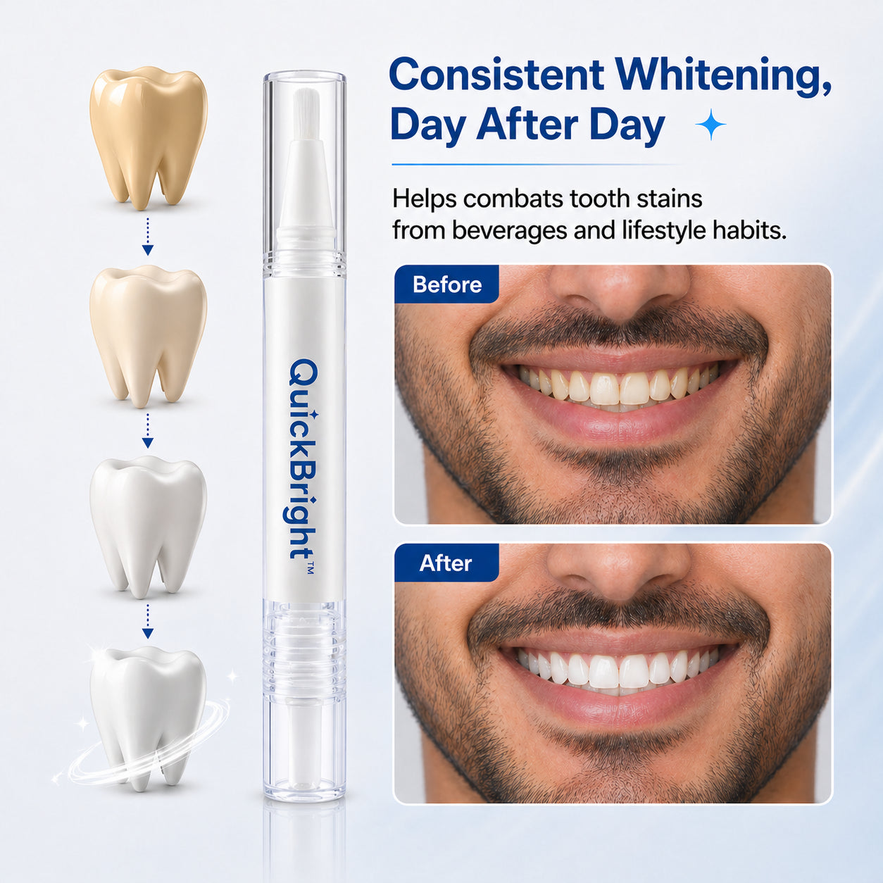 QuickBright™ Teeth Whitening Pen